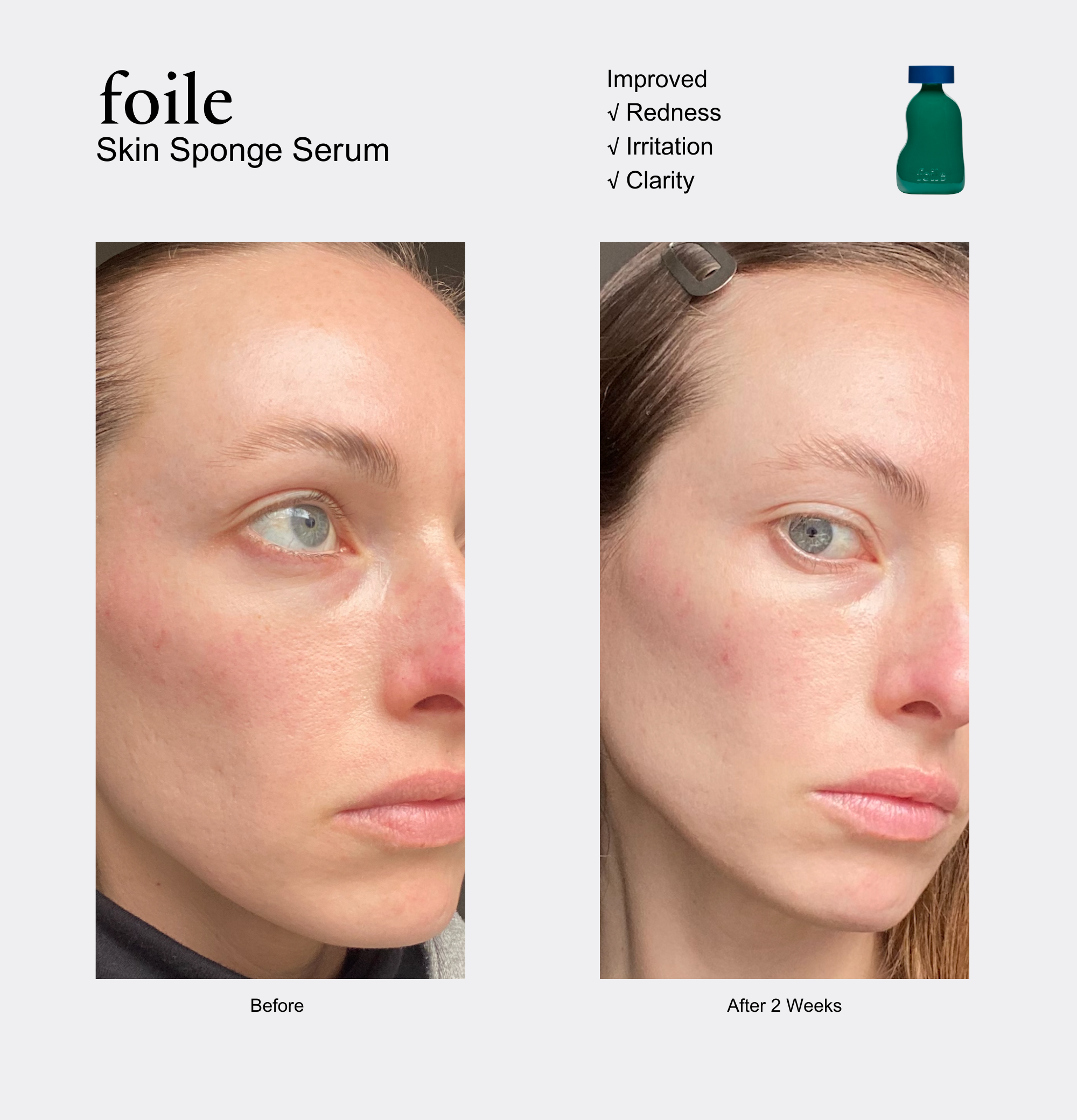Foile - Skin Sponge Serum